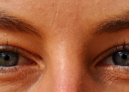 Best Dry Eye Treatment Options